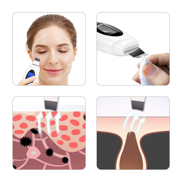 Multifunctional Blackhead