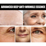 Anti-wrinkle Fine Line-fading Lifting